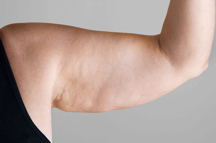 Arm Lift Clineca Health Tourism Agency in Turkey