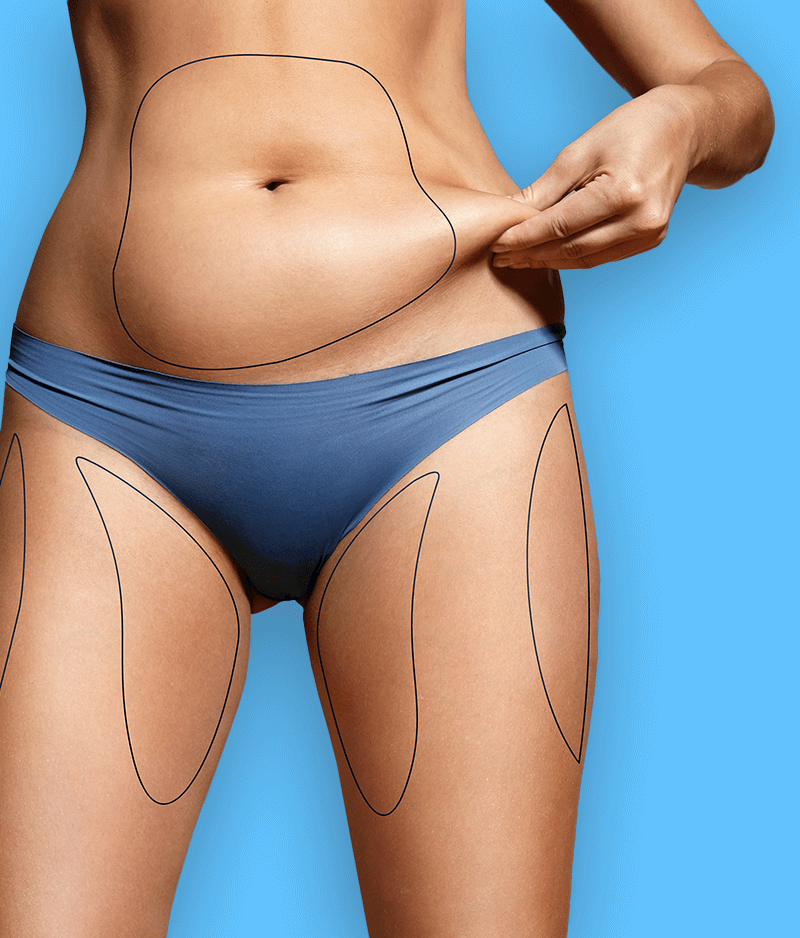 Liposuction Istanbul, Steps & Cost Advantages! - Global Clinic