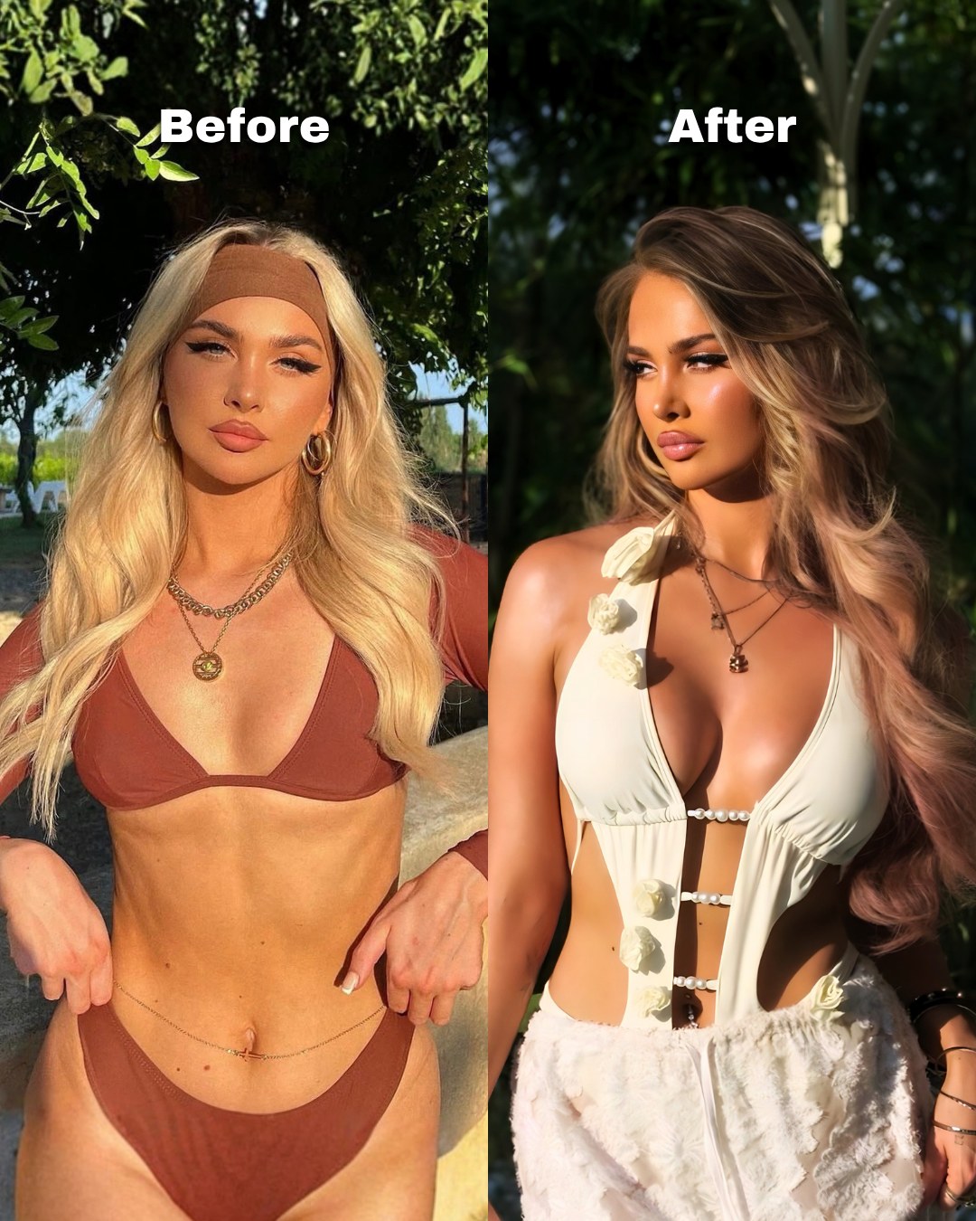 Breast surgery patient before and after, with restored fullness above the nipple