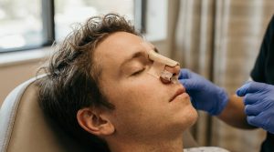 What Is Rhinoplasty and How Is It Performed: Steps and Risks